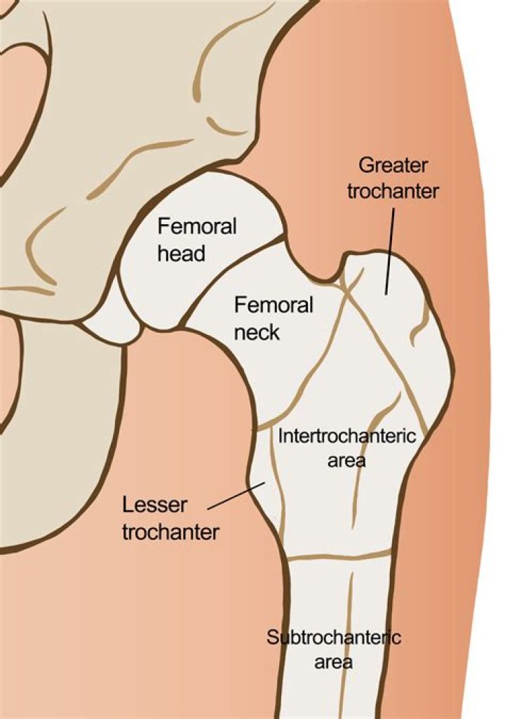 Where is the intertrochanteric fossa?