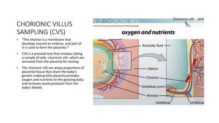 Which is chorionic villus sampling?