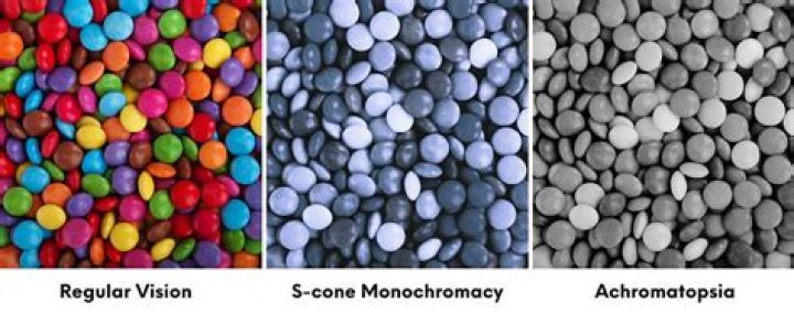 Who can get achromatopsia?