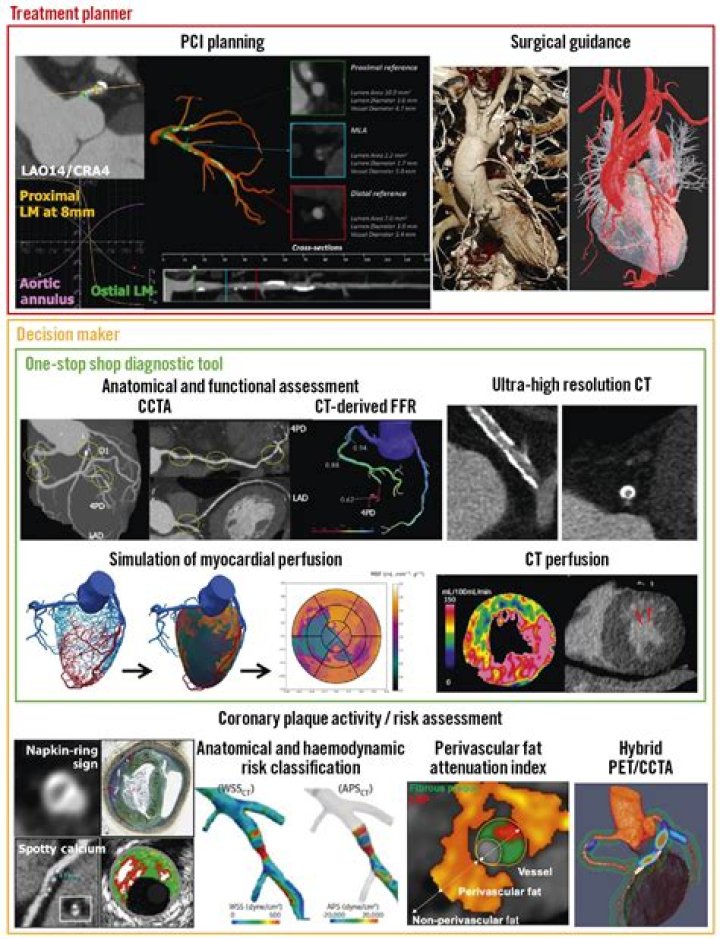 Who invented coronary angiogram?