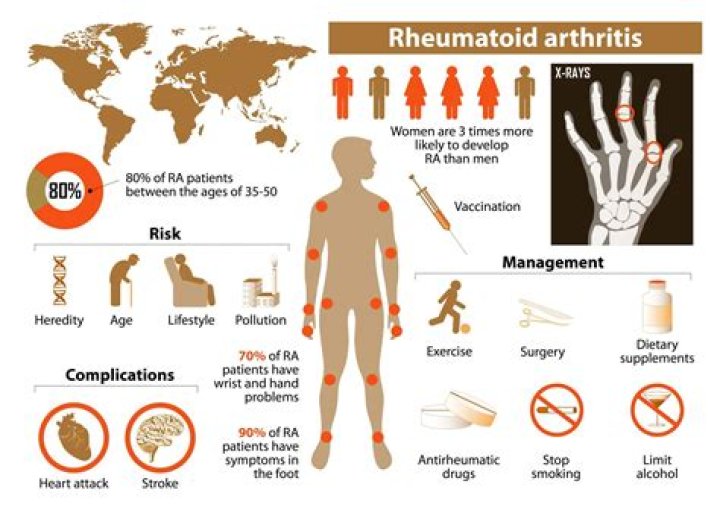 Who rheumatoid arthritis prevalence?