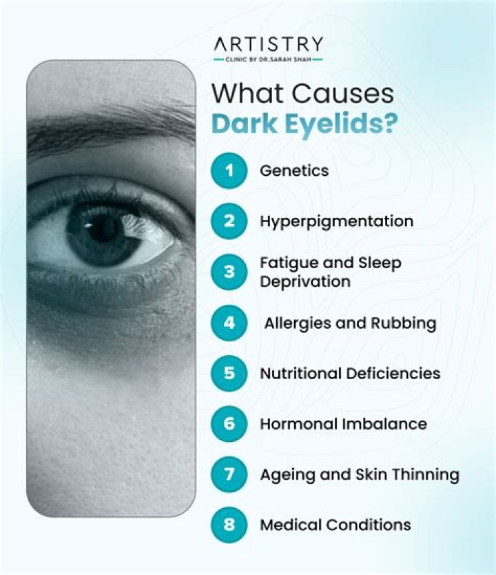 Why are my eyelids hyperpigmented?