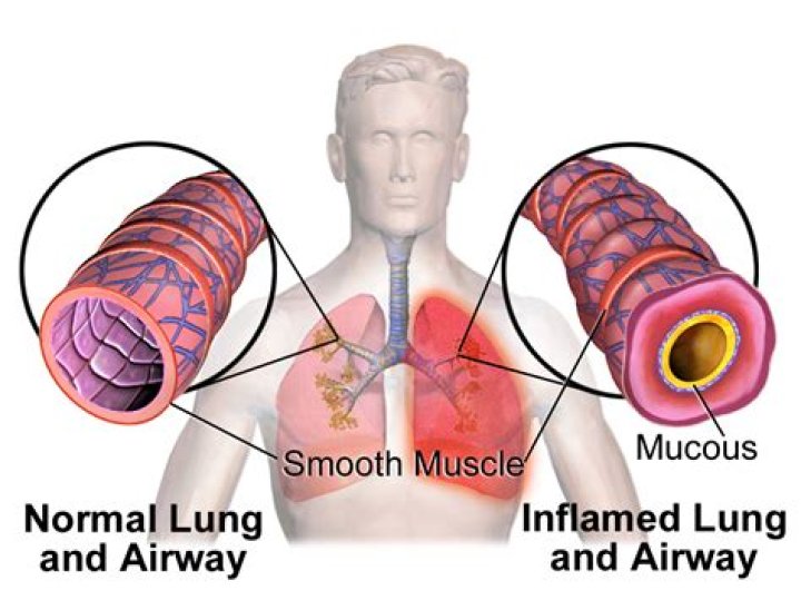 Why do bronchioles have smooth muscle?