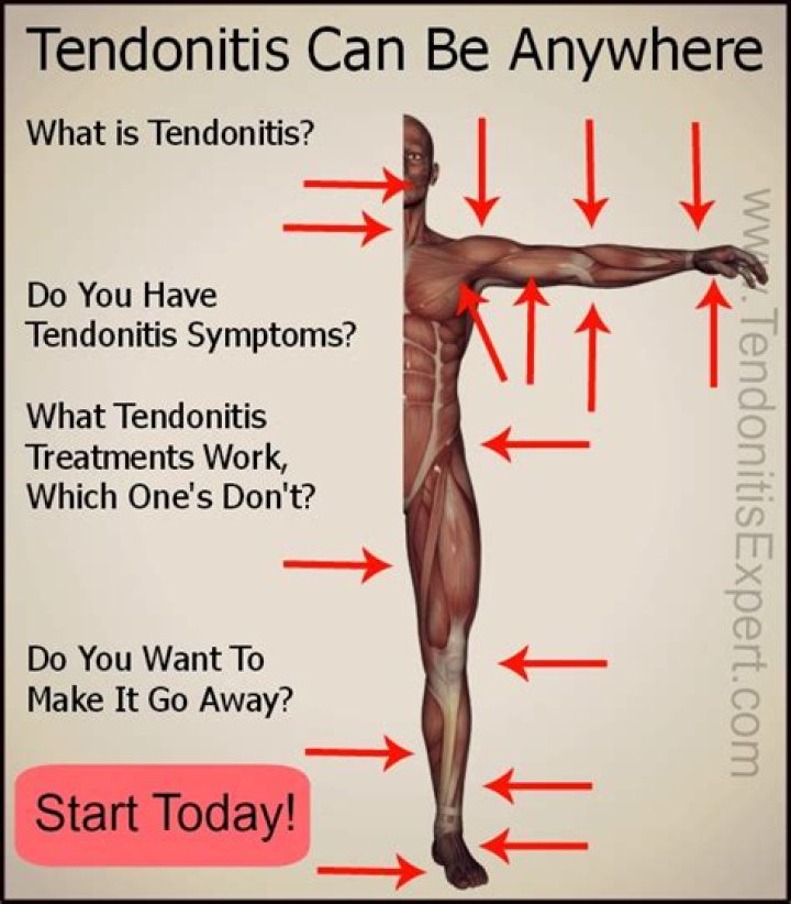 Why does tendonitis come and go?