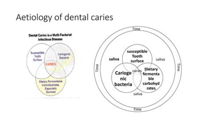 Why is the aetiology of dm called multifactorial?