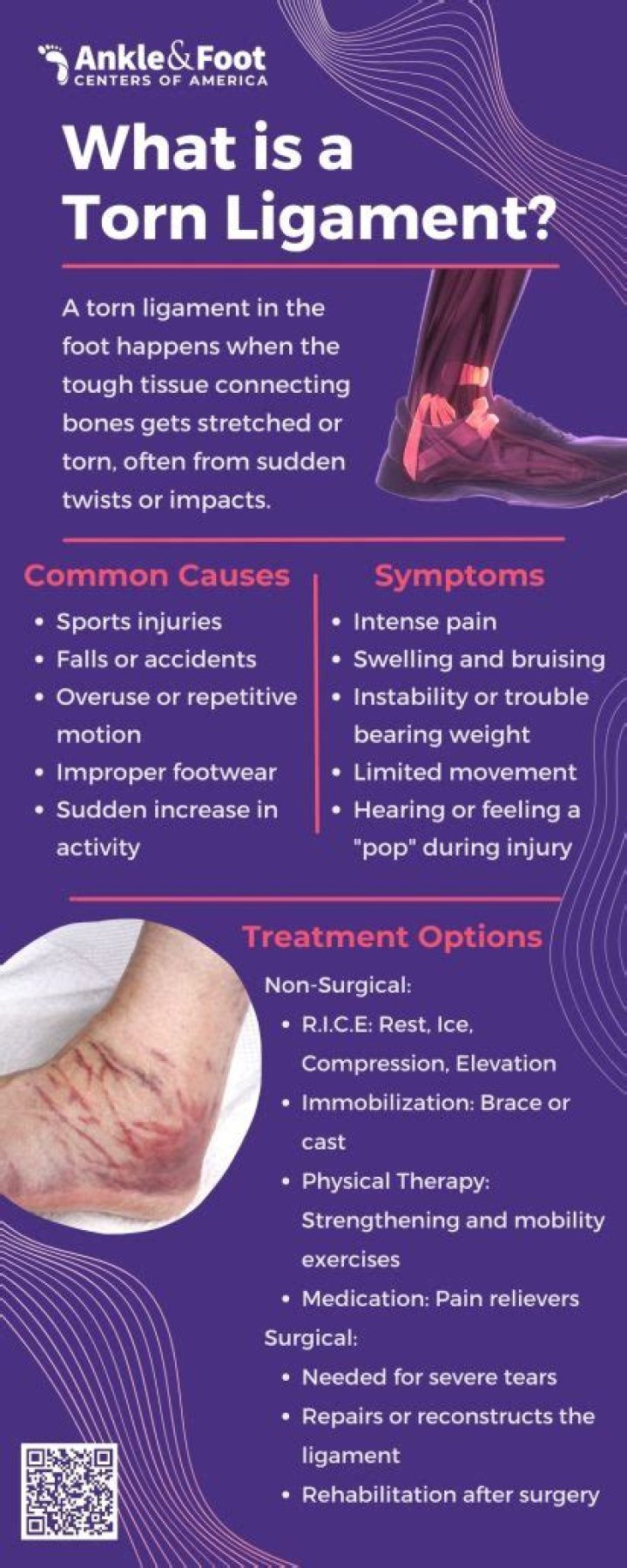 Why ligaments take longer to heal?