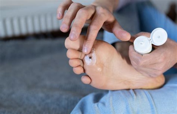 Will a planters wart bleed?