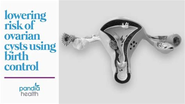 Will birth control shrink ovarian cysts?